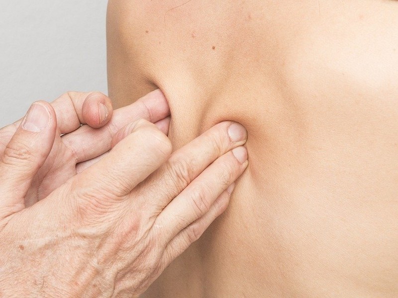 Sciatica Symptoms Relief Southport Near Me